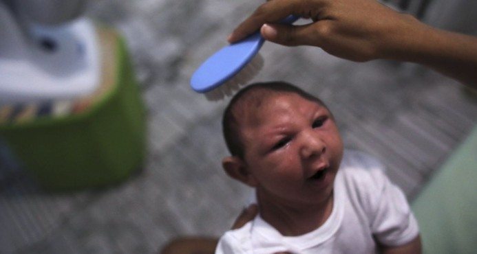 Registran 28 casos de microcefalia asociados al virus del zika en RD