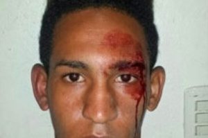 Multitud golpea a 2 jóvenes supuestamente asaltaban usando máscara en Villa Tapia