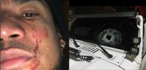 Hieren al cantante Vakeró durante un intento de asalto cuando salía de concierto en La Romana