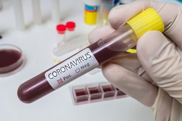 Reportan 405 nuevos casos de COVID-19 en RD; ya suman 19,600 con 538 muertes