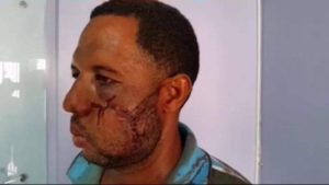 Hombre denuncia cabo le dio una paliza tras ser detenido en cuartel de Puerto Plata