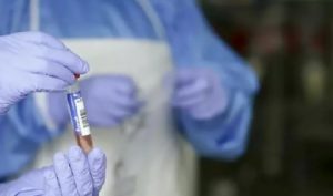 28 más y suman 1,738 las defunciones por Covid-19 en RD; los contagiados ascienden a 94,979