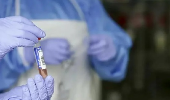 28 más y suman 1,738 las defunciones por Covid-19 en RD; los contagiados ascienden a 94,979