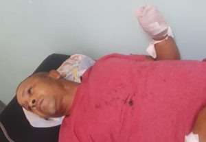 Le mutilan una mano de un machetazo a un regidor del PRM en Dajabón en medio de una riña