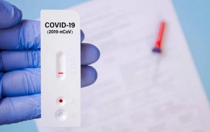 Salud Pública reporta 282 nuevos casos de coronavirus y dos muertes