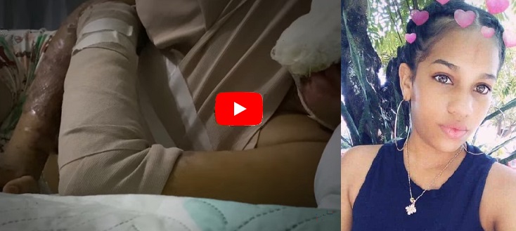 Hija de Yocairi, la joven rociada con ácido del diablo, se asusta al verla llegar a la casa pensando era un 