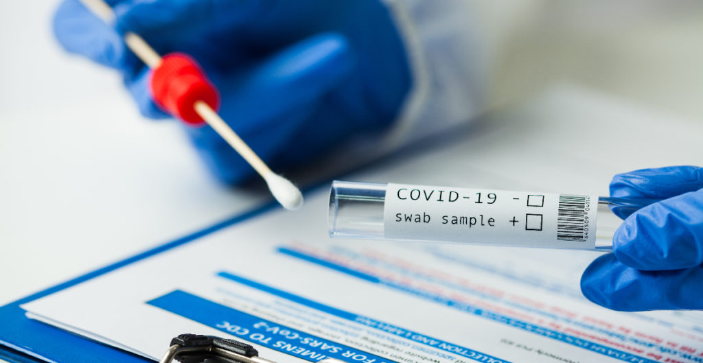 Salud Pública prohíbe importar y comercializar pruebas rápidas de Covid-19 a partir del 1 de febrero