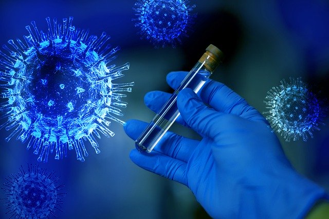 Salud Púbica reporta este domingo 902 nuevos contagios por Covid-19; positividad se sitúa en 21.87 %