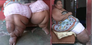 Mujer con 600 libras teme morir asfixiada por la obesidad y pide ayuda para realizarse una bariátrica