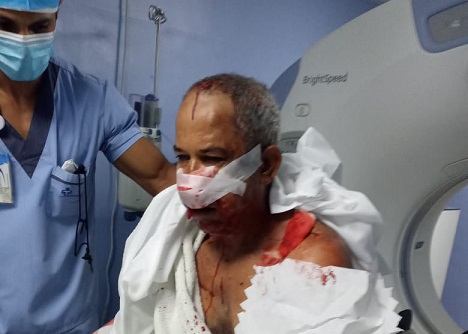 Haitianos asaltan en su finca y dejan mal herido a entrenador de béisbol en Montellano, Puerto Plata