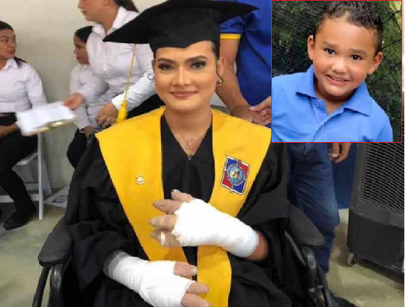 Se gradúa de médico madre sacrificó sus manos tratando de salvar su niño de 5 años murió por fuego carnaval de Salcedo