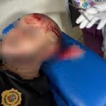 Haitianos agreden con palos, machetes y piedras a varios agente de Migración en Puerto Plata; hay uno herido