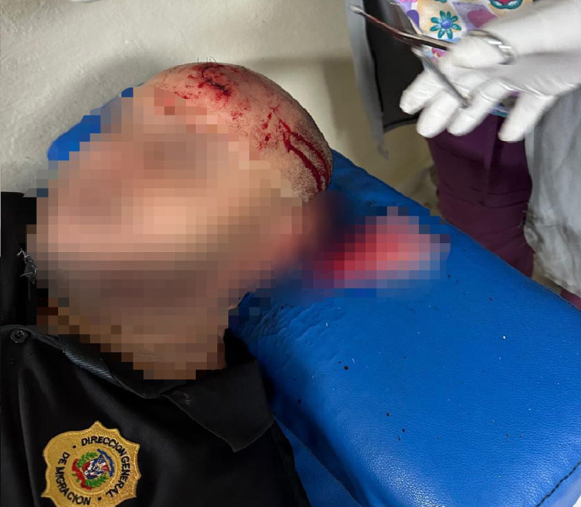Haitianos agreden con palos, machetes y piedras a varios agente de Migración en Puerto Plata; hay uno herido