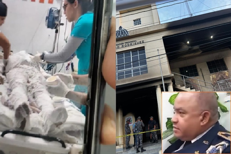 Fallece coronel de la PN resultó con quemaduras de tercer grado tras incendiarse cuartel policial en Santiago Rodríguez