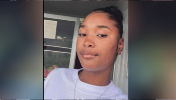 Otra más! Joven de 18 años recibe un tiro en la cara durante incidente en el sector NY Chiquito de Río San Juan