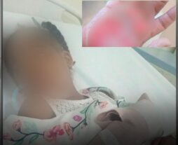 Dictan prisión contra la madrastra y el padre de niña de 10 años a quien quemaron sus manos en Los Alcarrizos