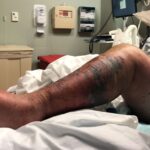 Encuentran bacteria carnívora en aguas Long Island pueden matar personas en 48 horas