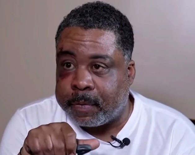 Hombre agredido por detectives en Brooklyn demanda al NYPD por 100 millones de dólares