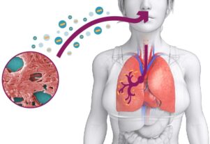 En NYC emergencia sin precedentes por brote Leionella; quien viva, trabaje o visite el área afectada, debe consultar profesional sanitario